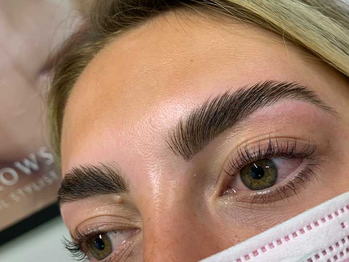 Eyebrow Treatments